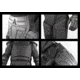Damascus Protective Gear Phenom6 PX6 Tactical Riot Suit, Black, 2XL/3XL, PX6 -2XL/3XL